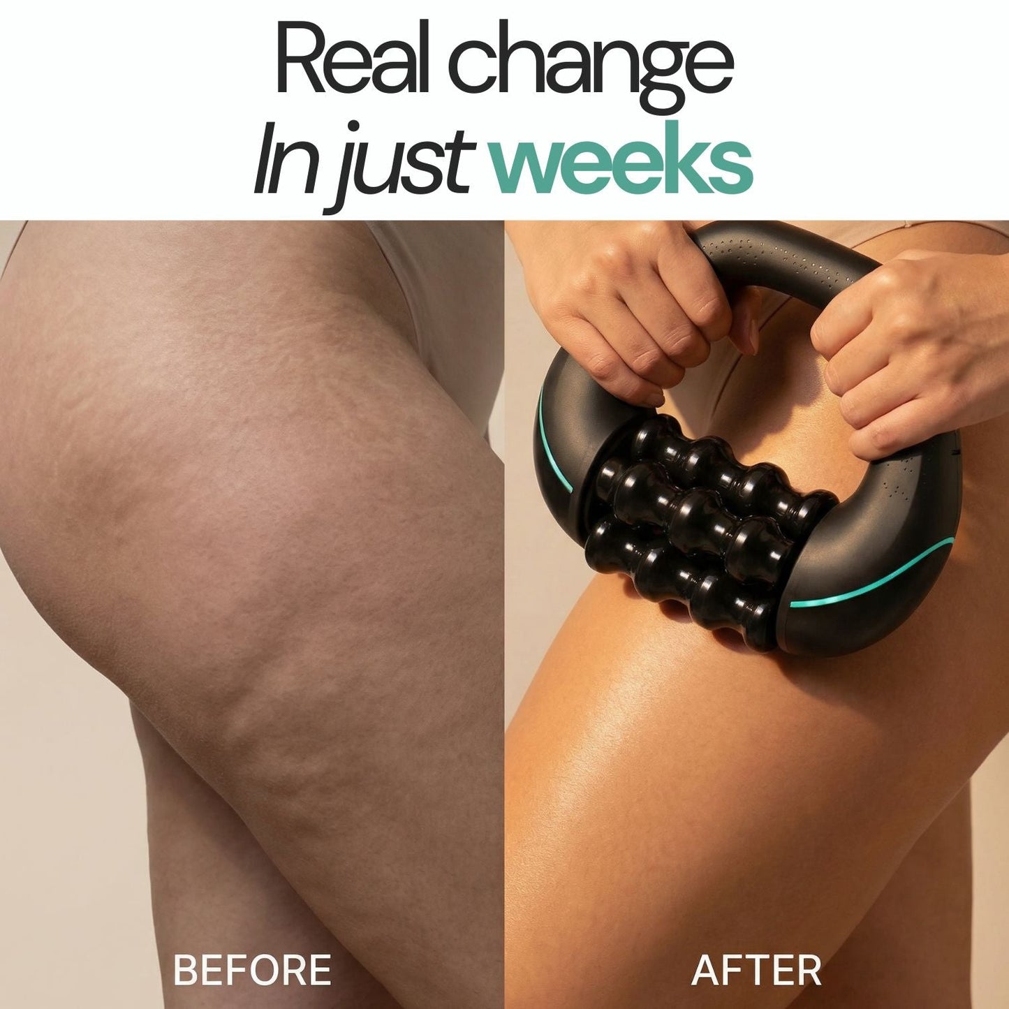 VireQuora™ Rollshaper